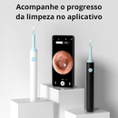 Otoscópio de Alta Precisão AeroSlim - Noram