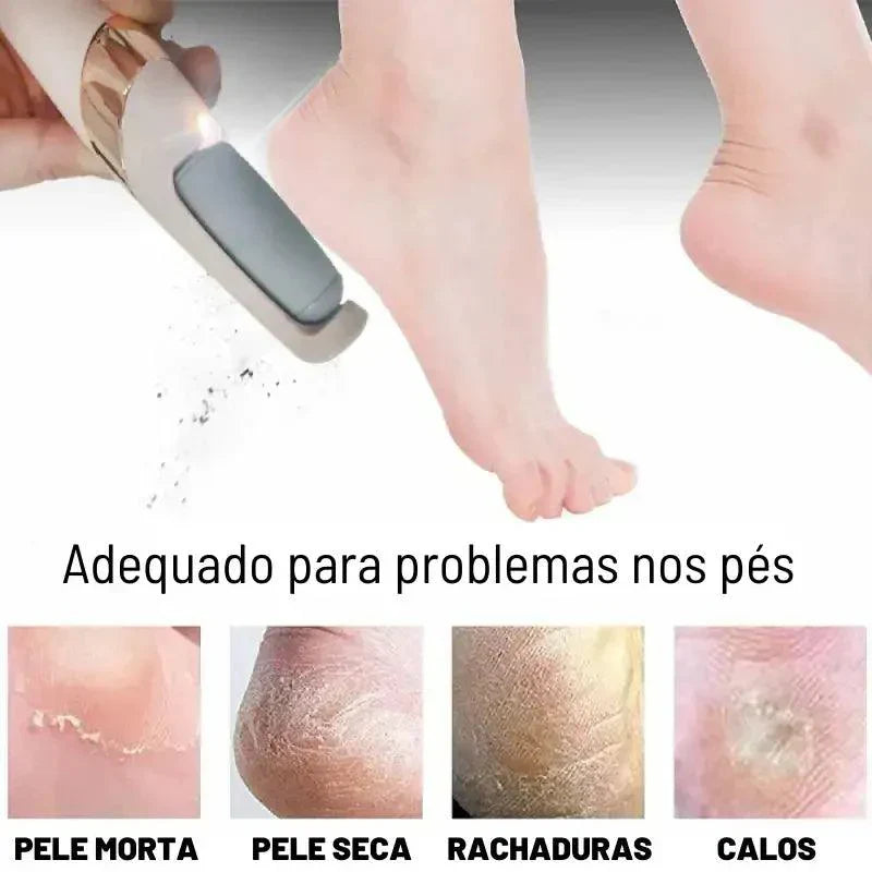 Lixa Esfoliadora Portátil - Soft Skin®